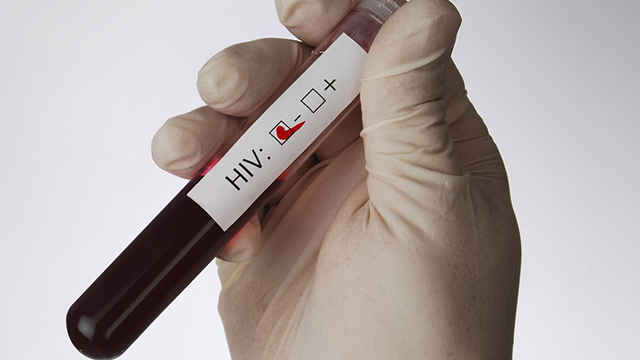 Negative HIV-Probe